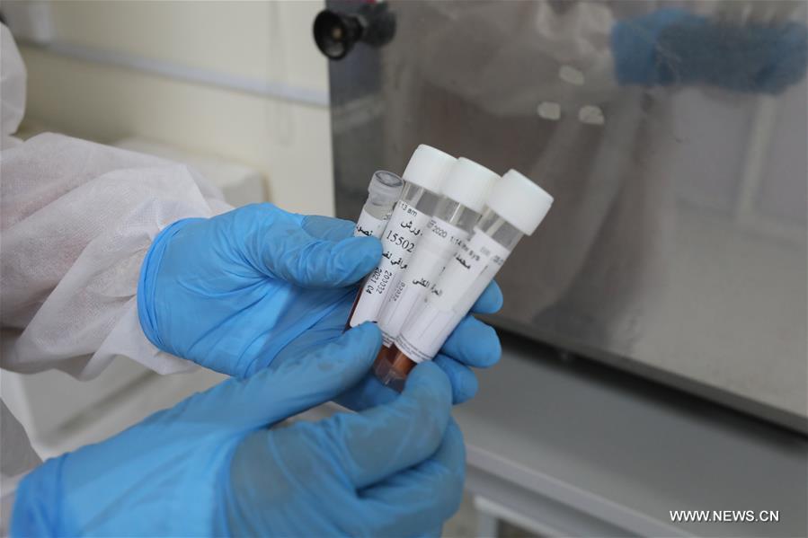 ????? : ?? ??? ???? ??????? ?????? ?? ?????? ??????? 